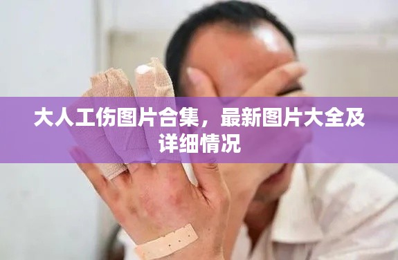 大人工伤图片合集,最新图片大全及详细情况